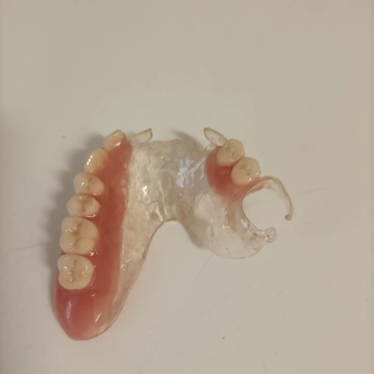 Lavorazione di una protesi in laboratorio