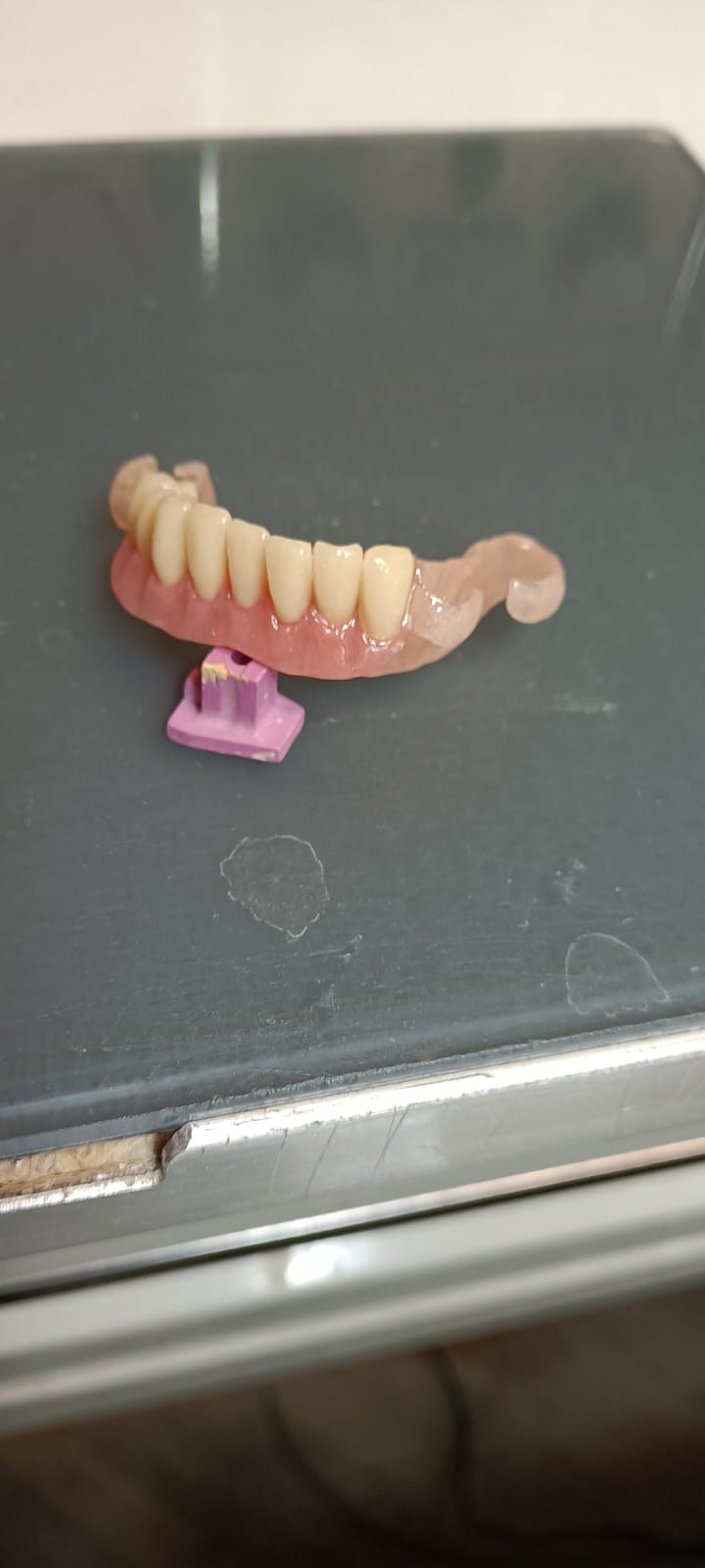 Dettaglio di una protesi fissa