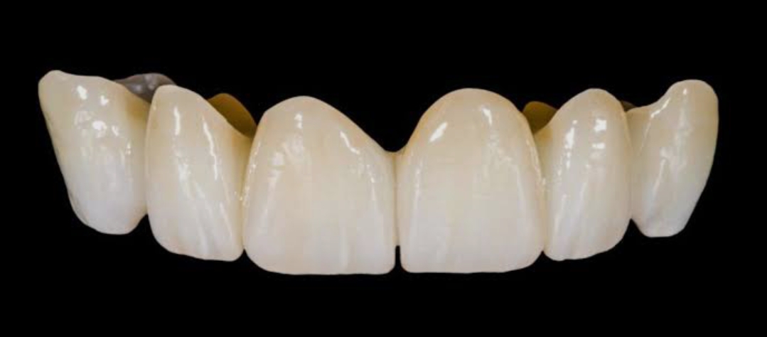 Gruppo frontale in ceramica