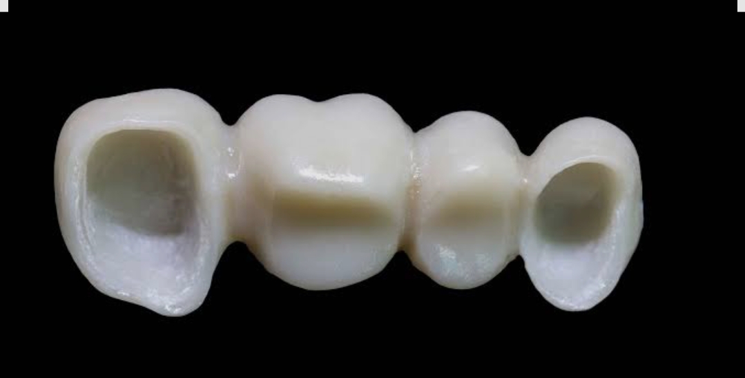 Ponte in zirconia